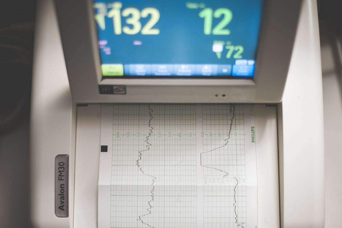 Utforska de bästa metoderna för att optimera din fordonsdiagnostik med ...